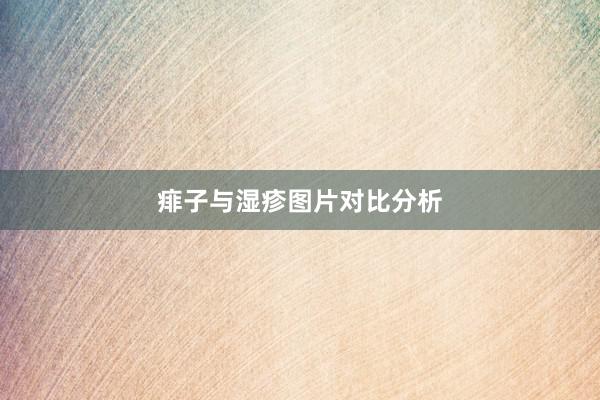 痱子与湿疹图片对比分析